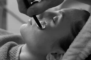 Tratamiento fraccional no ablativo - Everglowskin